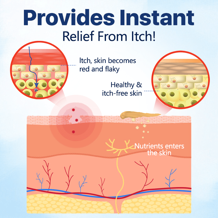Flycare™ Genital Relief Itch Cream