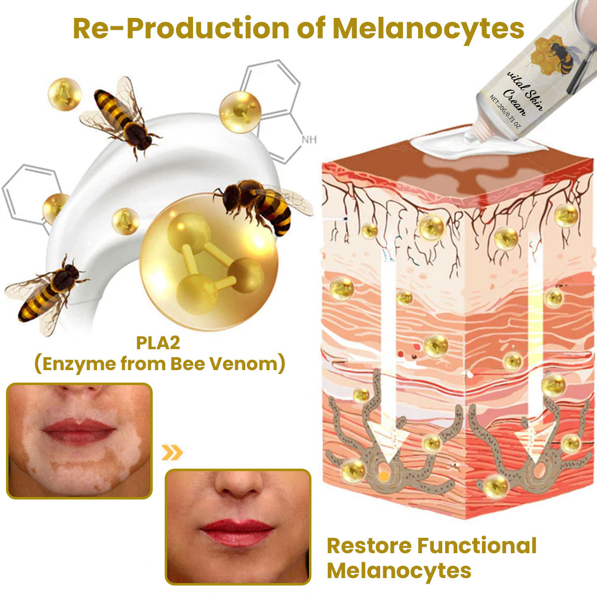 FLYCARE™ Vitiligo Bee Venom Care Skin Cream