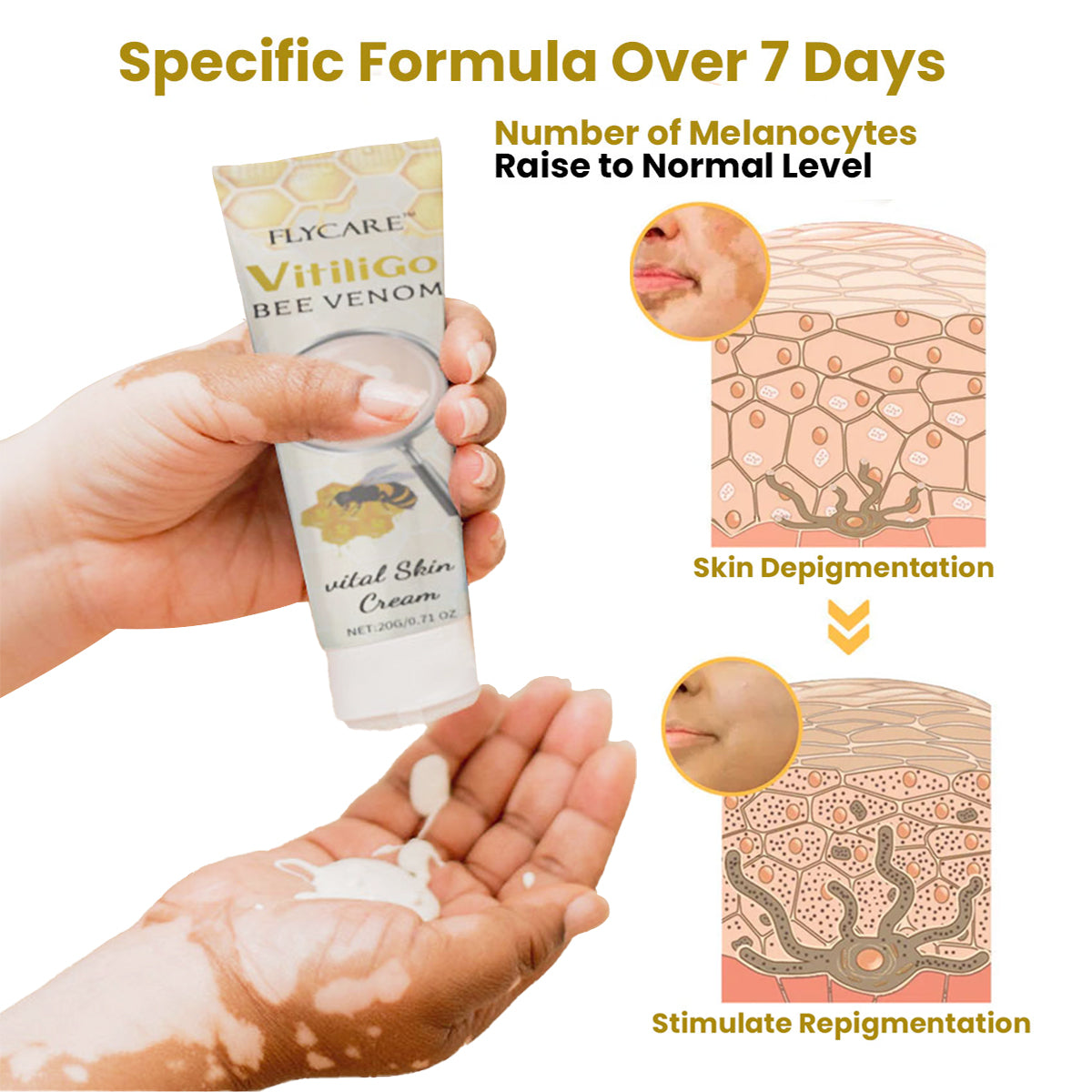 FLYCARE™ Vitiligo Bee Venom Care Skin Cream