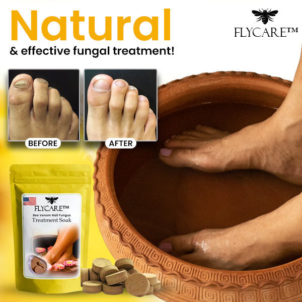 FLYCARE™ Bee Venom Nail Fungus Treatment Soak ⏰ SALE ENDS IN 10 MINUTES ⏰
