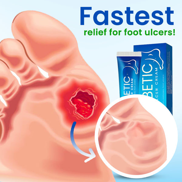 SootheStep™ Diabetic Foot Ulcer Cream - Sale up to 80% discounts!