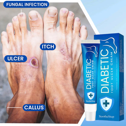 SootheStep™ Diabetic Foot Ulcer Cream - Sale up to 80% discounts!