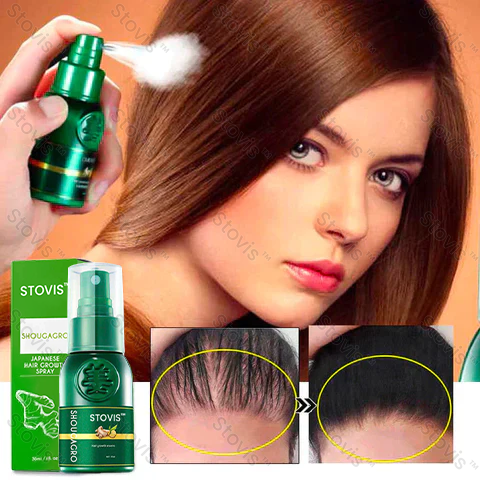 STOVIS™ ShougaGRO PRO Japanese Hair Growth Spray