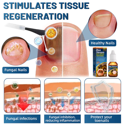 FLYCARE™ BeeVenom Nail Repair Treatment 🔥 Last Day Sale Off 70%🔥