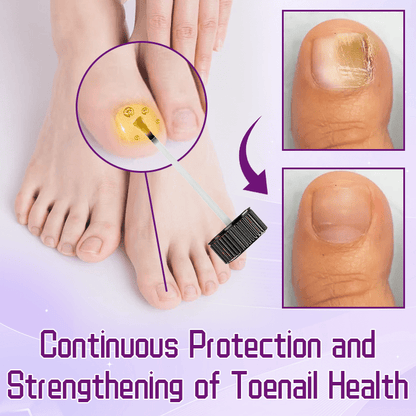 FLYCARE™  FungiGuard Bee Venom Toenail Serum