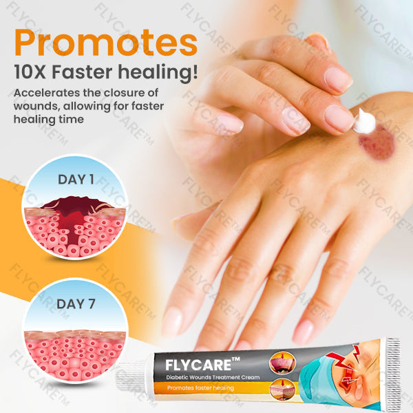 FLYCARE™ Diabetic Wounds Treatment Cream