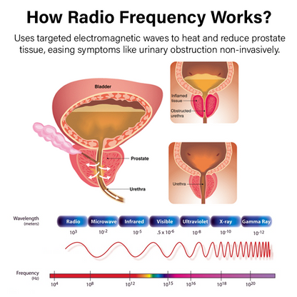 Flycare™ ProstateFlow RF Therapy Band Pro