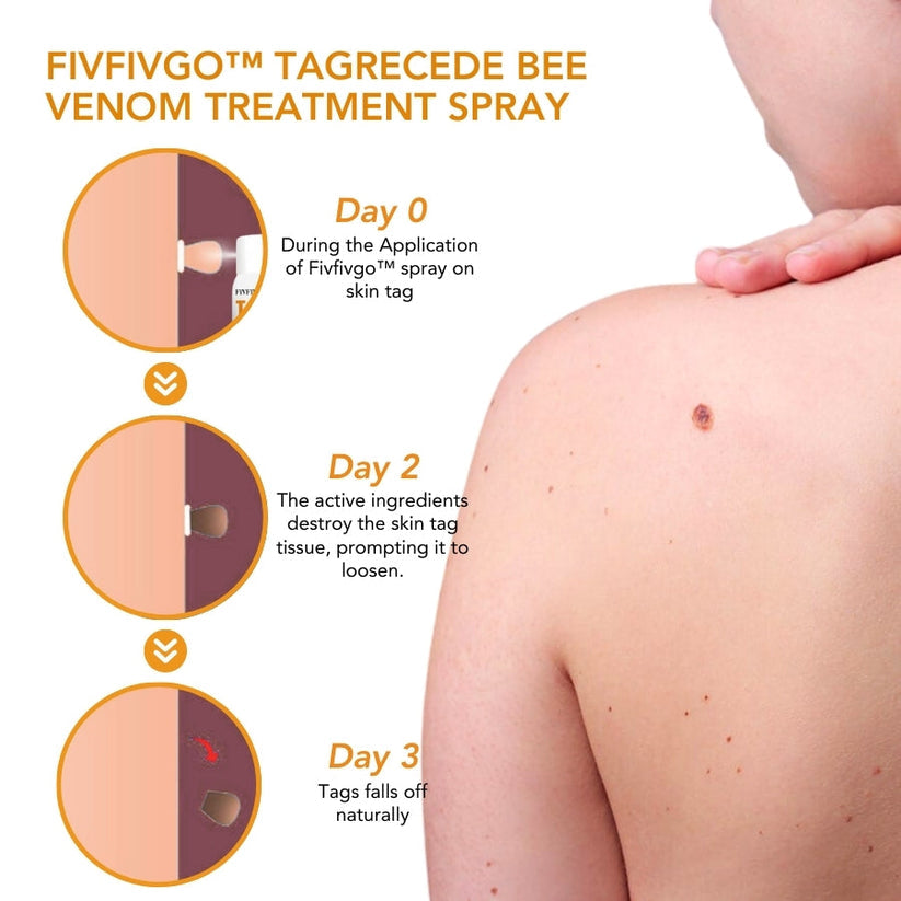 TagRecede Bee Venom Treatment Spray