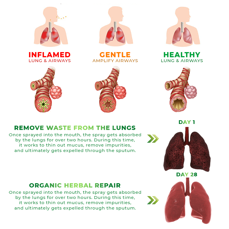 FLYCARE™ RespiAid Herbal Lung Cleansing Spray