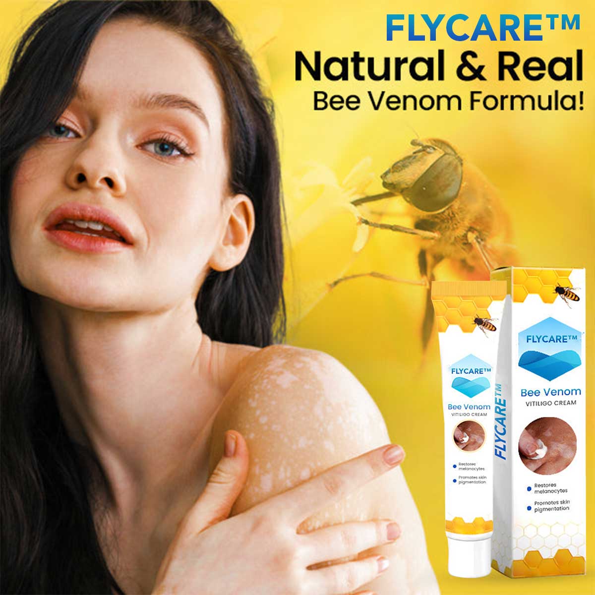 FLYCARE™ Bee Venom Vitiligo Cream