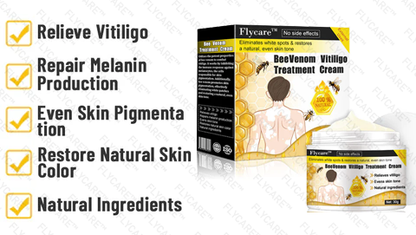 FLYCARE™ Bee Venom Vitiligo Treatment Cream