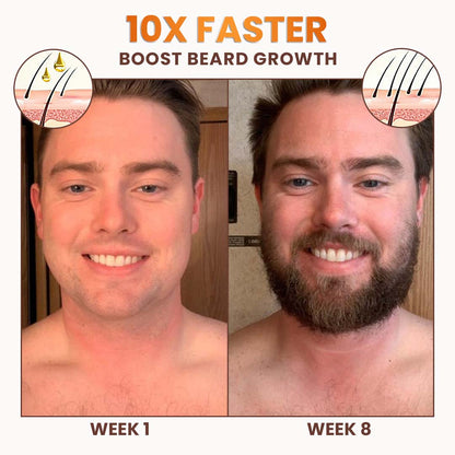 Stovis™ Premium Biotin Hair&Beard Booster ⏰ SALE ENDS IN 10 MINUTES ⏰