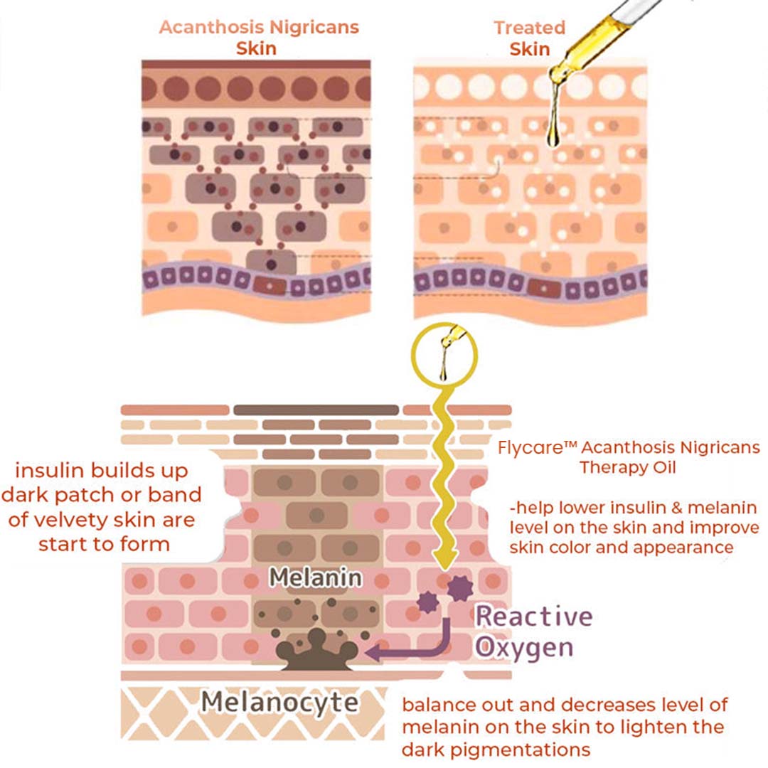 Flycare™ Acanthosis Nigricans Niacinamide Treatment Serum