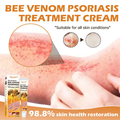 New Zealand Bee Venom Psoriasis Treatment Cream (Suitable for all skin conditions)