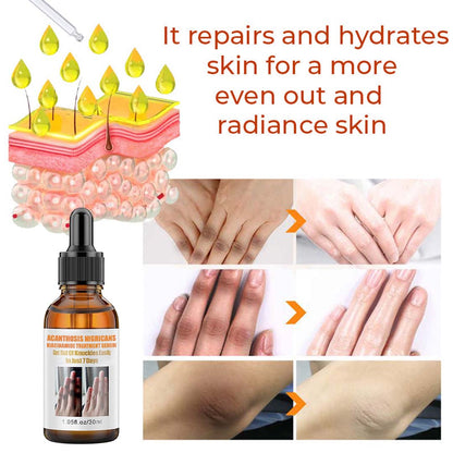 Flycare™ Acanthosis Nigricans Niacinamide Treatment Serum