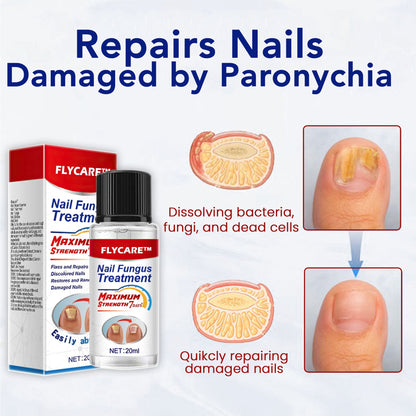 FLYCARE™ Nail Fungus Treatment Serum 🔥 Limited-time offer🔥