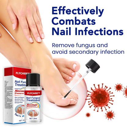 FLYCARE™ Nail Fungus Treatment Serum 🔥 Limited-time offer🔥