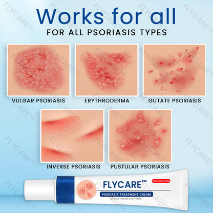 FLYCARE™ Psoriasis Treatment Cream 👩‍⚕️ Recommended by Experts